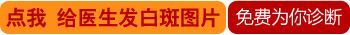 林芝白癜风的症状
